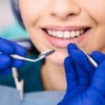 Bleeding gum care in villapuram, madurai